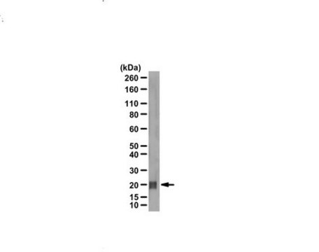 Anti-CDC42 Antibody, Brain Isoform-specific from rabbit, purified by affinity chromatography