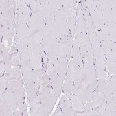 Anti-COL9A2 antibody produced in rabbit Prestige Antibodies&#174; Powered by Atlas Antibodies, affinity isolated antibody, buffered aqueous glycerol solution