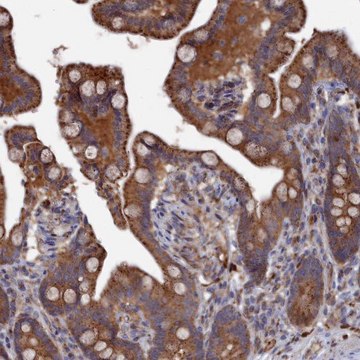 Anti-SMG9 antibody produced in rabbit Prestige Antibodies&#174; Powered by Atlas Antibodies, affinity isolated antibody, buffered aqueous glycerol solution