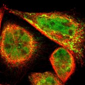 Anti-PDK2 antibody produced in rabbit Prestige Antibodies&#174; Powered by Atlas Antibodies, affinity isolated antibody, buffered aqueous glycerol solution