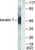 Anti-Keratin 7 antibody produced in rabbit affinity isolated antibody