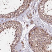 Anti-DMXL2 antibody produced in rabbit Prestige Antibodies&#174; Powered by Atlas Antibodies, affinity isolated antibody, buffered aqueous glycerol solution