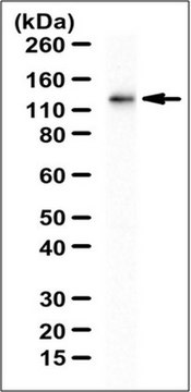 Anti-UBE4B Antibody from rabbit, purified by affinity chromatography