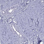 Anti-PPP1R3A antibody produced in rabbit Prestige Antibodies&#174; Powered by Atlas Antibodies, affinity isolated antibody, buffered aqueous glycerol solution