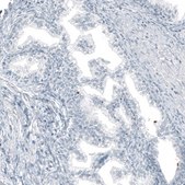 Monoclonal Anti-MUC5AC antibody produced in mouse Prestige Antibodies&#174; Powered by Atlas Antibodies, clone CL8961, purified immunoglobulin, buffered aqueous glycerol solution