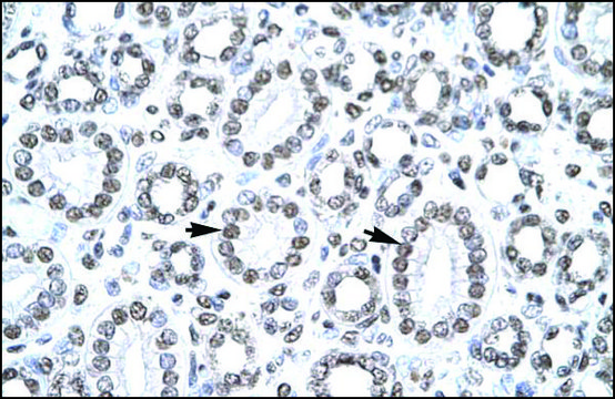 Anti-CITED1 antibody produced in rabbit affinity isolated antibody