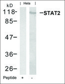 Anti-STAT2 (Ab-690) antibody produced in rabbit affinity isolated antibody