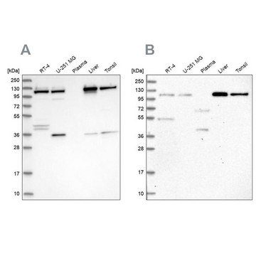 Anti-USO1 antibody produced in rabbit Prestige Antibodies&#174; Powered by Atlas Antibodies, affinity isolated antibody, buffered aqueous glycerol solution