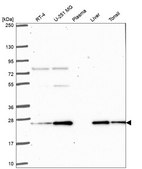 Anti-Prdx3 Antibody Produced In Rabbit Prestige Antibodies&#174; Powered by Atlas Antibodies, affinity isolated antibody, buffered aqueous glycerol solution