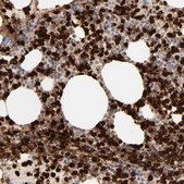 Anti-LCN2 antibody produced in rabbit Prestige Antibodies&#174; Powered by Atlas Antibodies, affinity isolated antibody, buffered aqueous glycerol solution