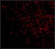 Anti-LGI2 (ab2) antibody produced in rabbit affinity isolated antibody, buffered aqueous solution