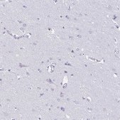 Anti-COL17A1 antibody produced in rabbit Prestige Antibodies&#174; Powered by Atlas Antibodies, affinity isolated antibody, buffered aqueous glycerol solution