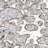 Monoclonal Anti-HDAC5 antibody produced in mouse Prestige Antibodies&#174; Powered by Atlas Antibodies, clone CL8121, purified immunoglobulin, buffered aqueous glycerol solution