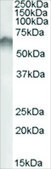 Anti-CRHR1/CRF-R (AA 107-117) antibody produced in goat affinity isolated antibody, buffered aqueous solution