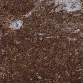 Anti-PSMB10 antibody produced in rabbit Prestige Antibodies&#174; Powered by Atlas Antibodies, affinity isolated antibody, buffered aqueous glycerol solution