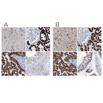 Anti-ALDH6A1 antibody produced in rabbit Prestige Antibodies&#174; Powered by Atlas Antibodies, affinity isolated antibody, buffered aqueous glycerol solution, ab2