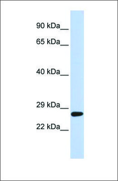 Anti-SETD4 antibody produced in rabbit affinity isolated antibody