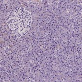 Anti-CD45 antibody produced in rabbit Prestige Antibodies&#174; Powered by Atlas Antibodies, affinity isolated antibody, buffered aqueous glycerol solution