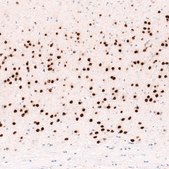 Monoclonal Anti-FOXP2 antibody produced in mouse Prestige Antibodies&#174; Powered by Atlas Antibodies, clone CL5310, purified immunoglobulin, buffered aqueous glycerol solution