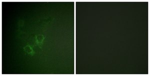 Anti-AHR antibody produced in rabbit affinity isolated antibody