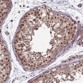 Anti-DDIT3 antibody produced in rabbit Prestige Antibodies&#174; Powered by Atlas Antibodies, affinity isolated antibody, buffered aqueous glycerol solution