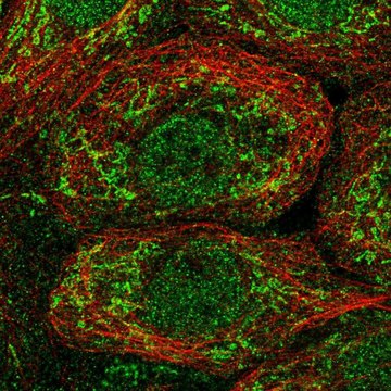 Anti-OAT antibody produced in rabbit Prestige Antibodies&#174; Powered by Atlas Antibodies, affinity isolated antibody
