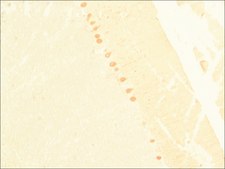 Anti-Calbindin-D-28K (KD-15) antibody produced in rabbit affinity isolated antibody, buffered aqueous solution