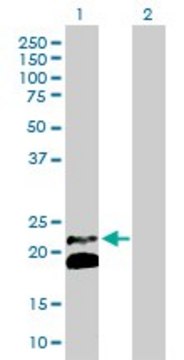 Anti-IFNB1 antibody produced in rabbit purified immunoglobulin, buffered aqueous solution
