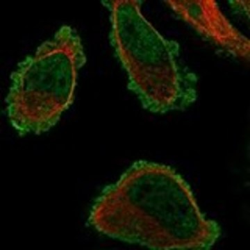 Anti-TMEM101 antibody produced in rabbit Prestige Antibodies&#174; Powered by Atlas Antibodies, affinity isolated antibody, buffered aqueous glycerol solution