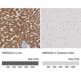 Anti-HMGCS2 antibody produced in rabbit Prestige Antibodies&#174; Powered by Atlas Antibodies, affinity isolated antibody, buffered aqueous glycerol solution