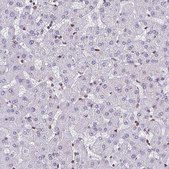 Anti-LMNB2 antibody produced in rabbit Prestige Antibodies&#174; Powered by Atlas Antibodies, affinity isolated antibody, buffered aqueous glycerol solution