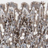 Anti-FNDC3A antibody produced in rabbit Ab1, Prestige Antibodies&#174; Powered by Atlas Antibodies, affinity isolated antibody, buffered aqueous glycerol solution