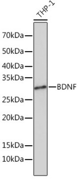 Anti-BDNF Antibody, clone 2B0U9, Rabbit Monoclonal