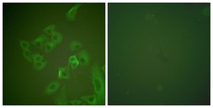 Anti-Synuclein &#946; antibody produced in rabbit affinity isolated antibody