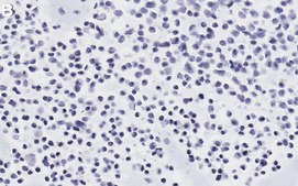 Anti-Adenovirus Antibody, clone 20/11 ZooMAb&#174; Mouse Monoclonal recombinant, expressed in HEK 293 cells