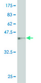 Monoclonal Anti-HEMK2 antibody produced in mouse clone 1C4, purified immunoglobulin, buffered aqueous solution