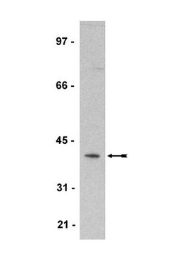 Anti-Spry2 Antibody Upstate&#174;, from rabbit