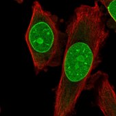 Anti-TRIB3 antibody produced in rabbit Prestige Antibodies&#174; Powered by Atlas Antibodies, affinity isolated antibody