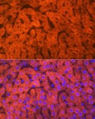 Anti-Hemopexin (HPX) antibody produced in rabbit