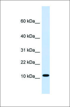Anti-HMGN1 (ab2) antibody produced in rabbit affinity isolated antibody