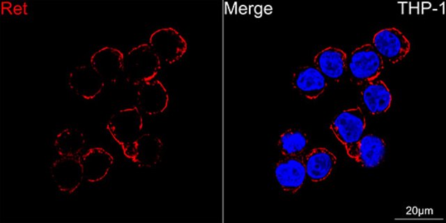 Anti-Ret Antibody, clone 3U8T6, Rabbit Monoclonal