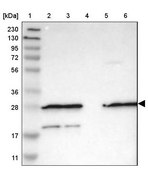 Anti-FNTA antibody produced in rabbit Prestige Antibodies&#174; Powered by Atlas Antibodies, affinity isolated antibody, buffered aqueous glycerol solution