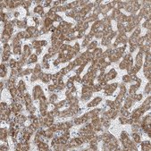 Anti-TNS2 antibody produced in rabbit Prestige Antibodies&#174; Powered by Atlas Antibodies, affinity isolated antibody, buffered aqueous glycerol solution