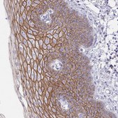 Anti-DSC3 antibody produced in rabbit Prestige Antibodies&#174; Powered by Atlas Antibodies, affinity isolated antibody, buffered aqueous glycerol solution