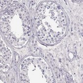 Anti-SLC18A1 antibody produced in rabbit Prestige Antibodies&#174; Powered by Atlas Antibodies, affinity isolated antibody