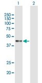 Anti-ACAA1 antibody produced in mouse purified immunoglobulin, buffered aqueous solution