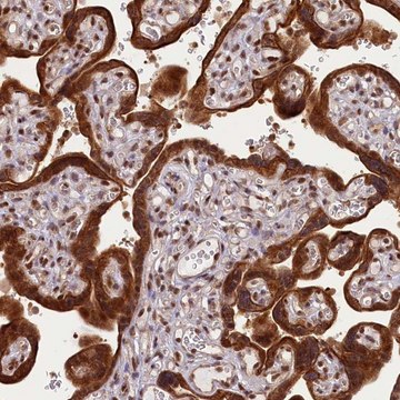 Anti-CARD8 antibody produced in rabbit Prestige Antibodies&#174; Powered by Atlas Antibodies, affinity isolated antibody, buffered aqueous glycerol solution
