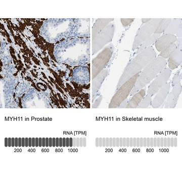 Anti-MYH11 antibody produced in rabbit Prestige Antibodies&#174; Powered by Atlas Antibodies, affinity isolated antibody, buffered aqueous glycerol solution