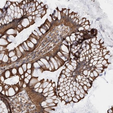 Anti-KIF12 antibody produced in rabbit Prestige Antibodies&#174; Powered by Atlas Antibodies, affinity isolated antibody, buffered aqueous glycerol solution, Ab2