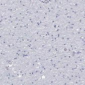 Anti-CD40LG antibody produced in rabbit Prestige Antibodies&#174; Powered by Atlas Antibodies, affinity isolated antibody, buffered aqueous glycerol solution